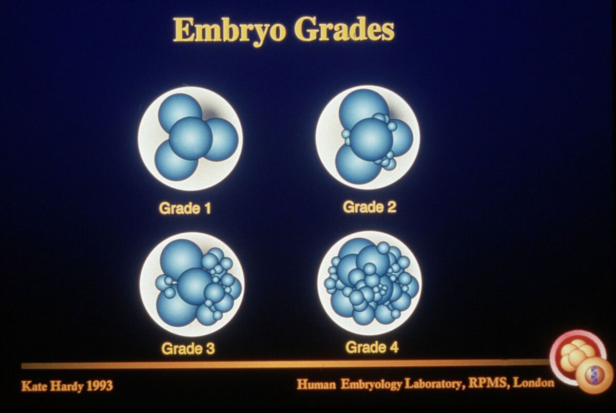 Human embryo grading used in IVF (diagram)