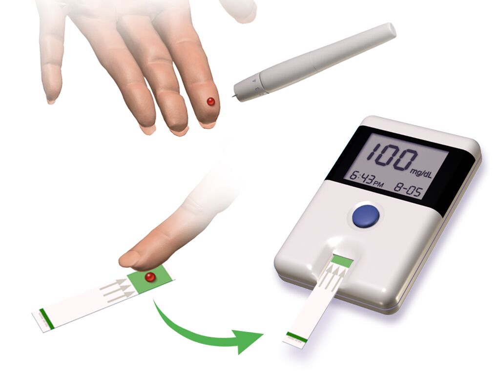 Blood glucose monitoring (diagram)