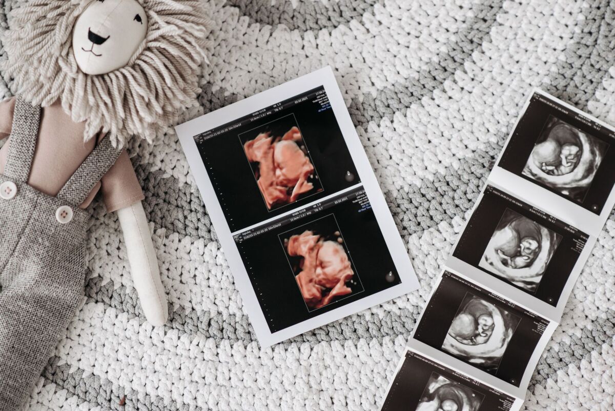 A baby ultrasound printout next to a lion stuffed toy on a knitted rug, symbolizing prenatal care.