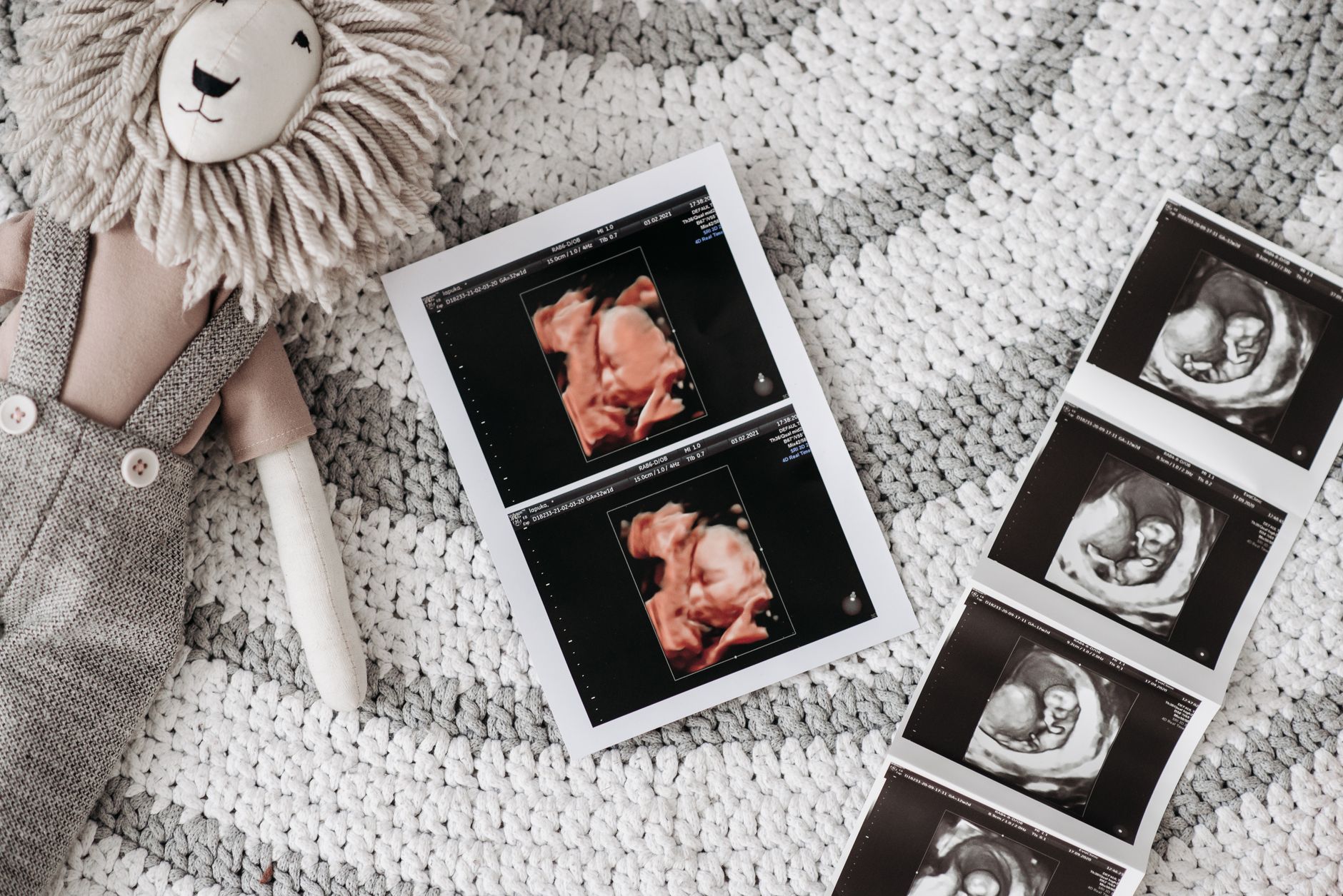 A baby ultrasound printout next to a lion stuffed toy on a knitted rug, symbolizing prenatal care.