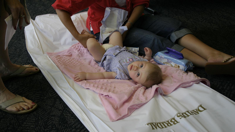 Diaper Rash: Causes, Treatment and Prevention