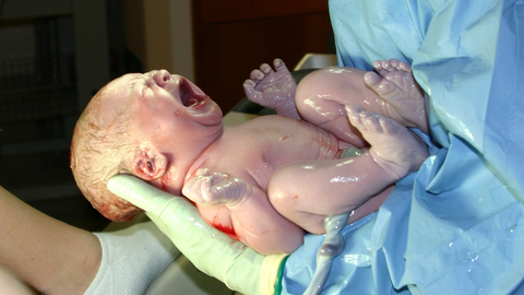 Hospital maternity packages in Singapore: what delivery really costs
